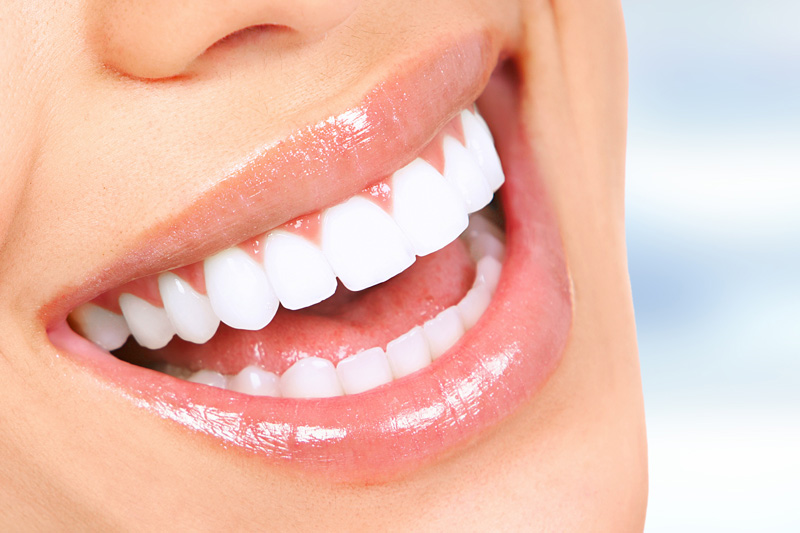 Cosmetic Dentistry in Mt Pleasant